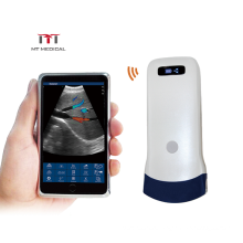 Wireless Ultrasound Machine / Mini USG Connected Mobile Phone Tablet PC Baby Ultrasound
